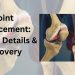 Joint Replacement Surgery