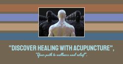 Redmond acupuncture