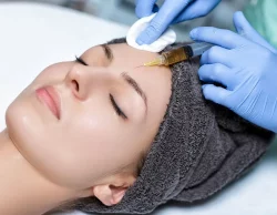 A beautiful women getting face prp therapy