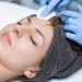 A beautiful women getting face prp therapy