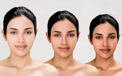 3 woman's how to change face color from whitening injection