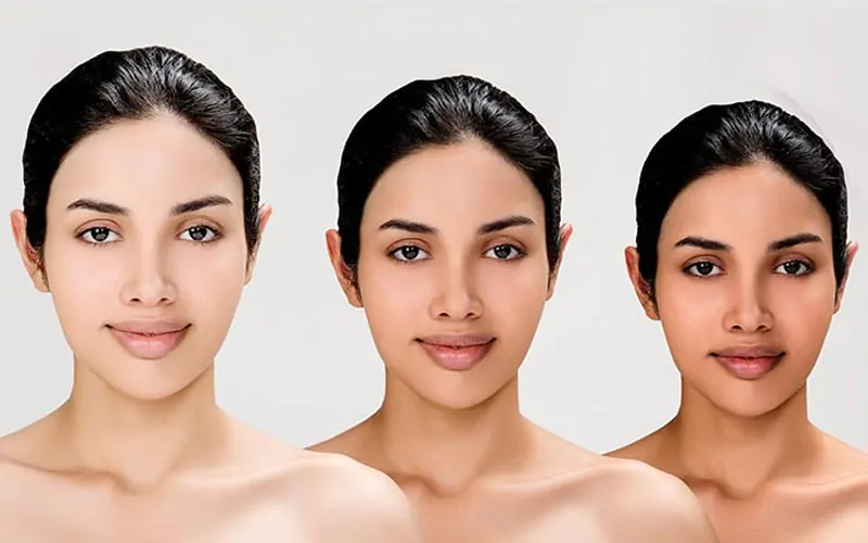 3 woman's how to change face color from whitening injection