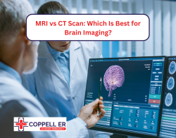 brain cat scan vs mri