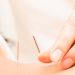 fertility acupuncture Melbourne