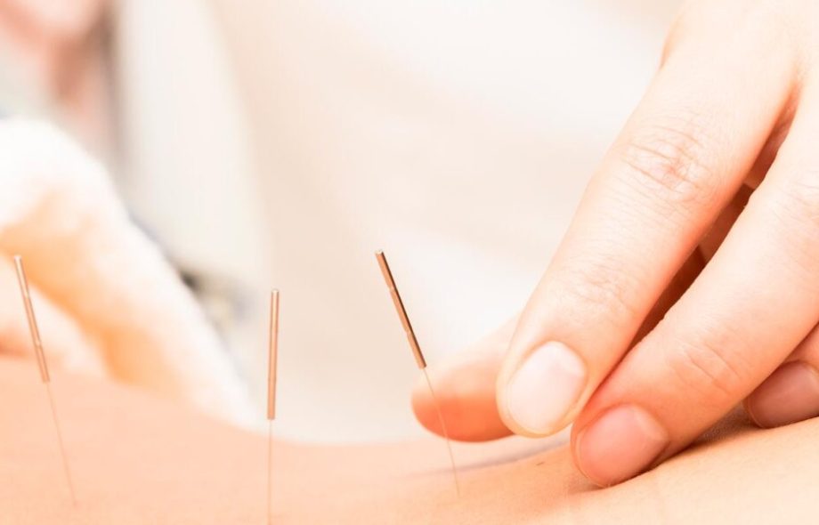 fertility acupuncture Melbourne