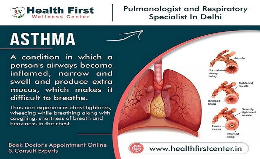 Asthma Doctor Near Me