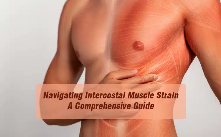 intercostal muscle strain