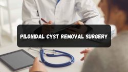 pilonidal cyst removal surgery