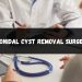 pilonidal cyst removal surgery