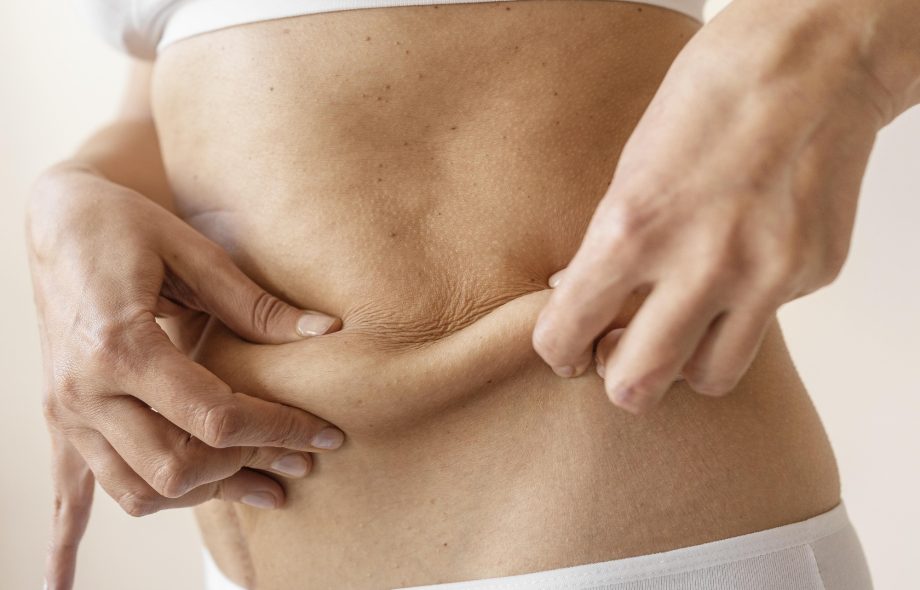 weight loss surgery