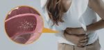 How Do I Know If I Have a Parasite Infection