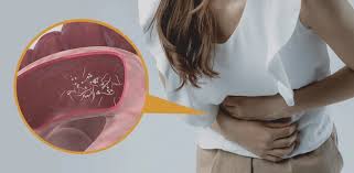 How Do I Know If I Have a Parasite Infection
