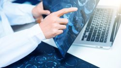 MRI imaging Los Angeles