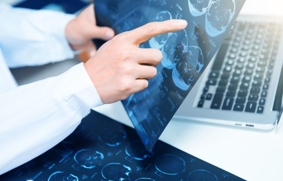 MRI imaging Los Angeles