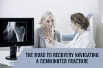 comminuted bone break