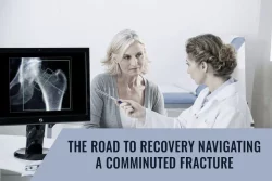 comminuted bone break