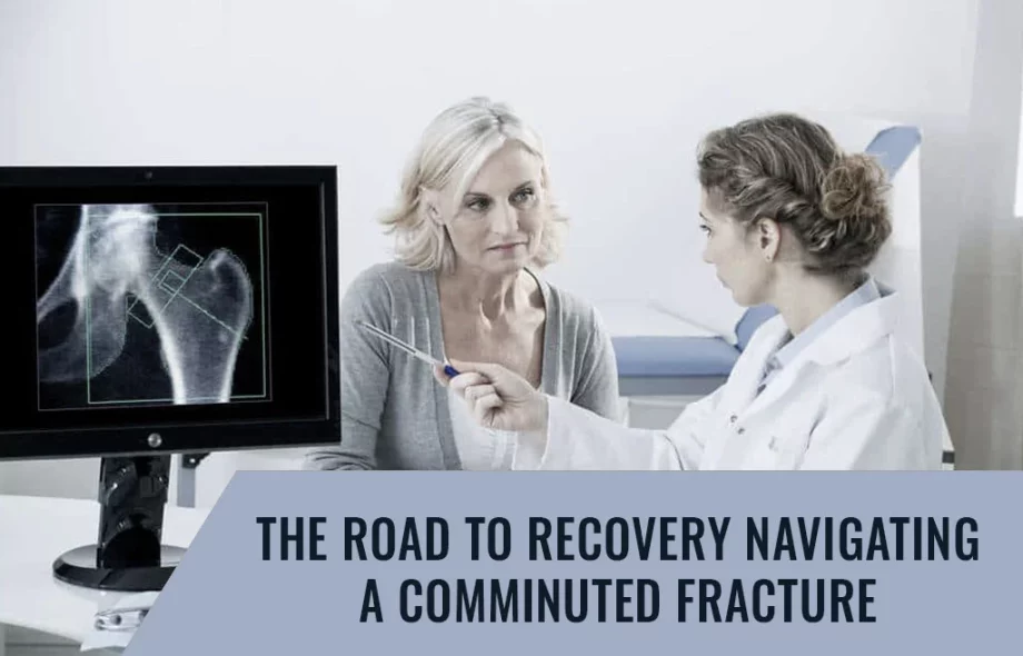 comminuted bone break