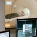 MRI with Contrast Make You Tired