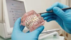 Best Dental Braces Costing in Ahmedabad