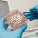 Best Dental Braces Costing in Ahmedabad