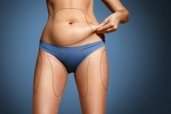 BodyTite Liposuction Riyadh