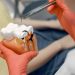 Root Canal Treatment in Ahmedabad