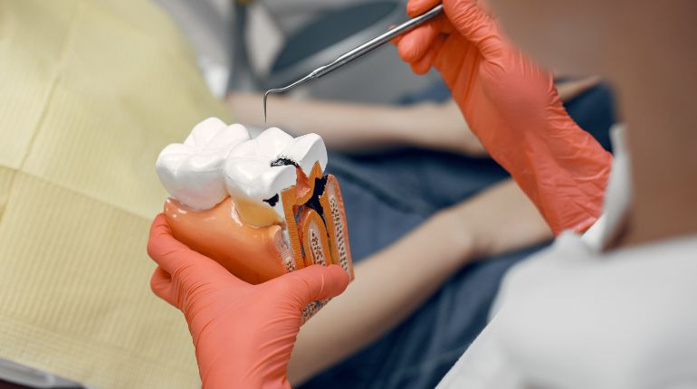 Root Canal Treatment in Ahmedabad