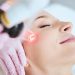 Laser Treatment Dubai