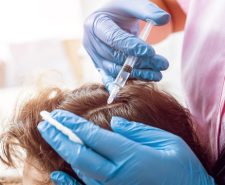 Plasma injection for hairs Dubai