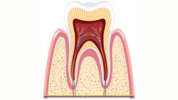 Root Canal Treatment in Ahmedabad