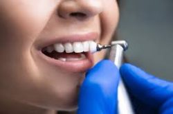 Dental Cleaning