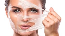 التقشير الكيميائي