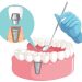 Dental Implants Cost Ahmedabad