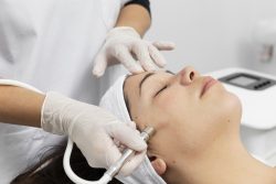 microneedling Toronto