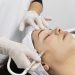 microneedling Toronto